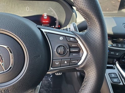 2025 Acura TLX w/A-Spec Package